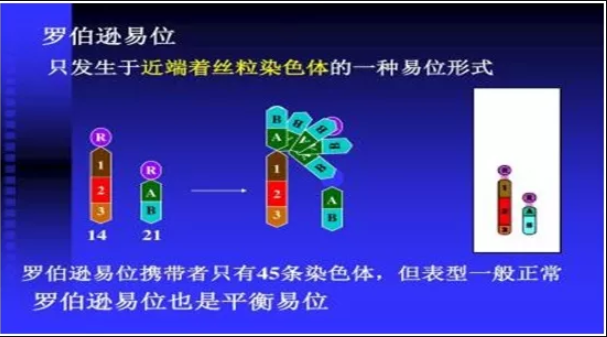 染色体筛查之染色体平衡易位与罗氏易位携带者有什么区别